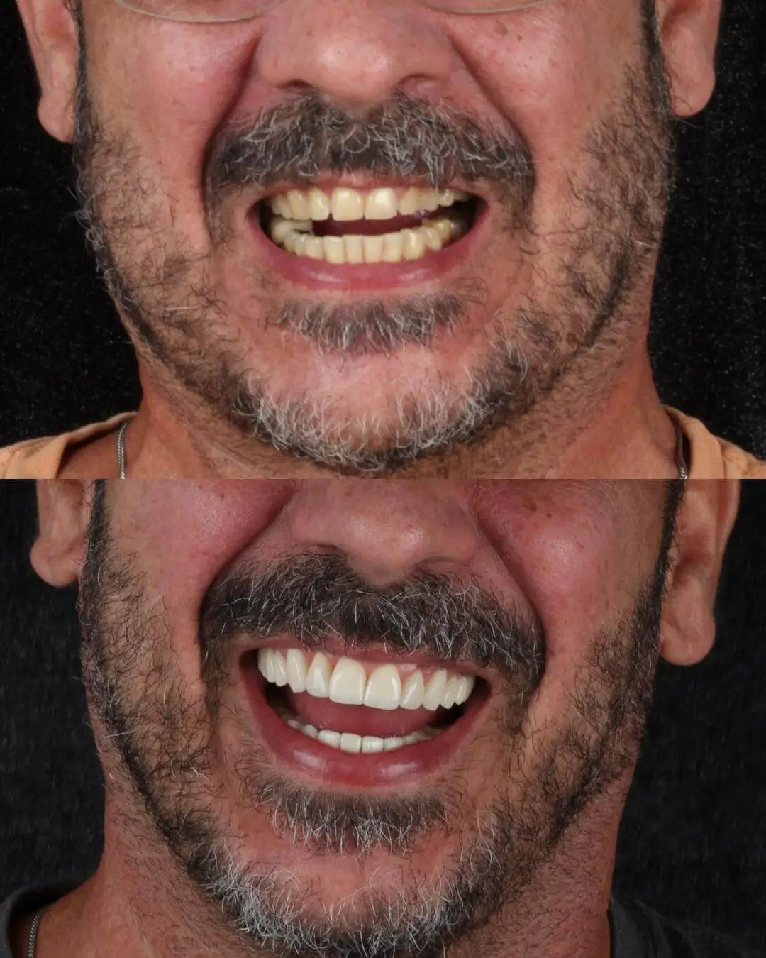 Odontologia Estetica (OT) DOWN