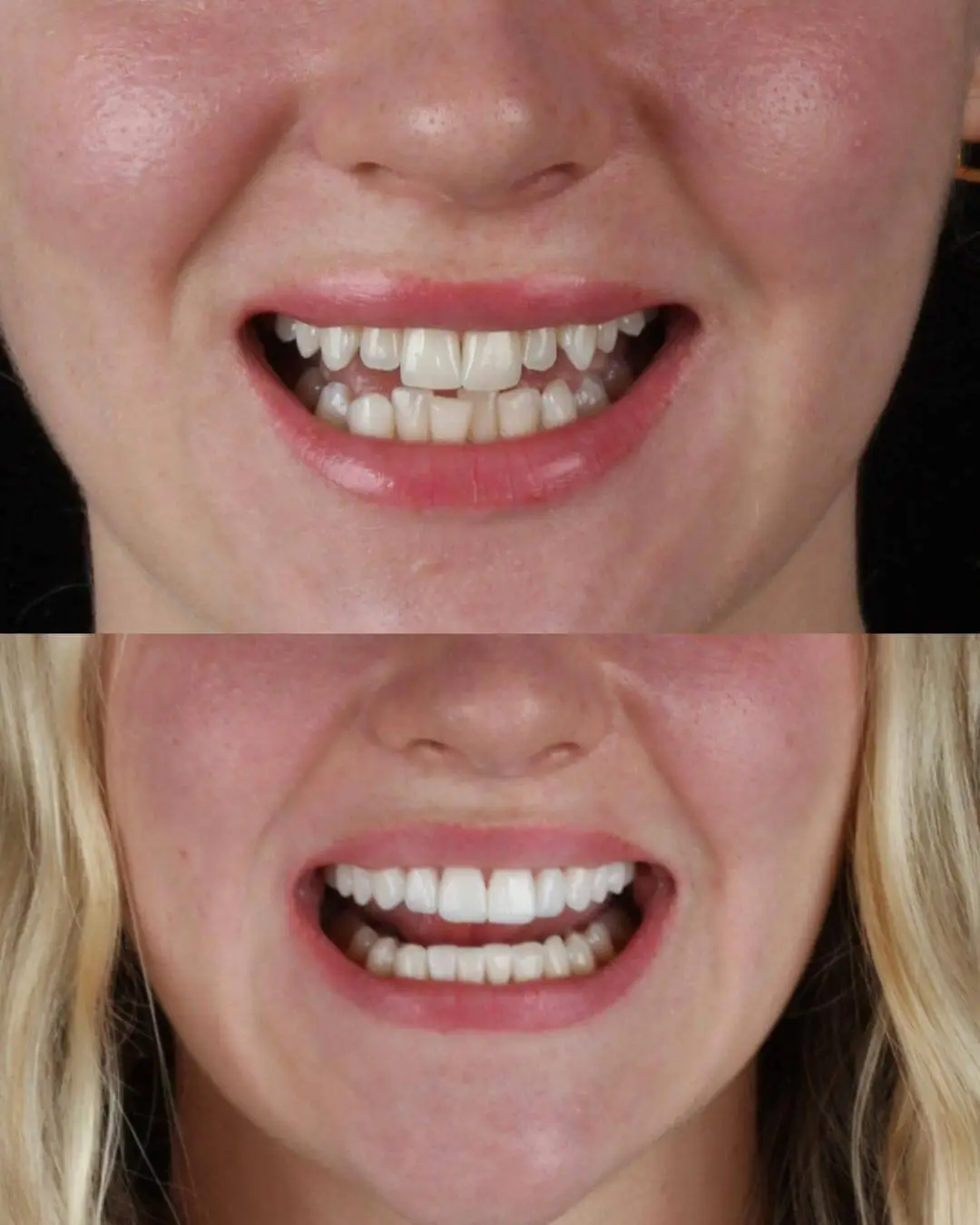 Odontologia Estetica (OT)