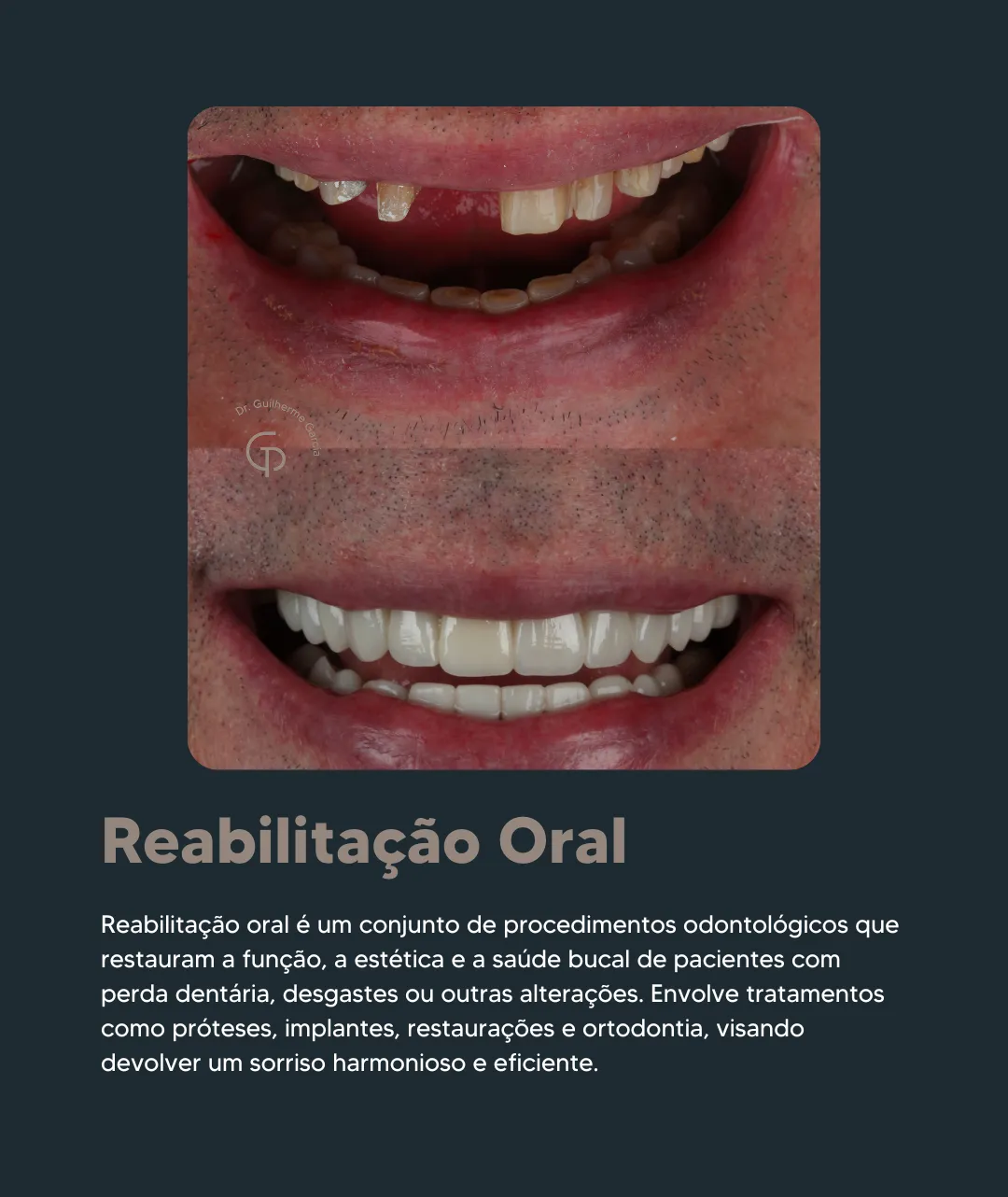 Reabilatação Oral 1080 (OT)